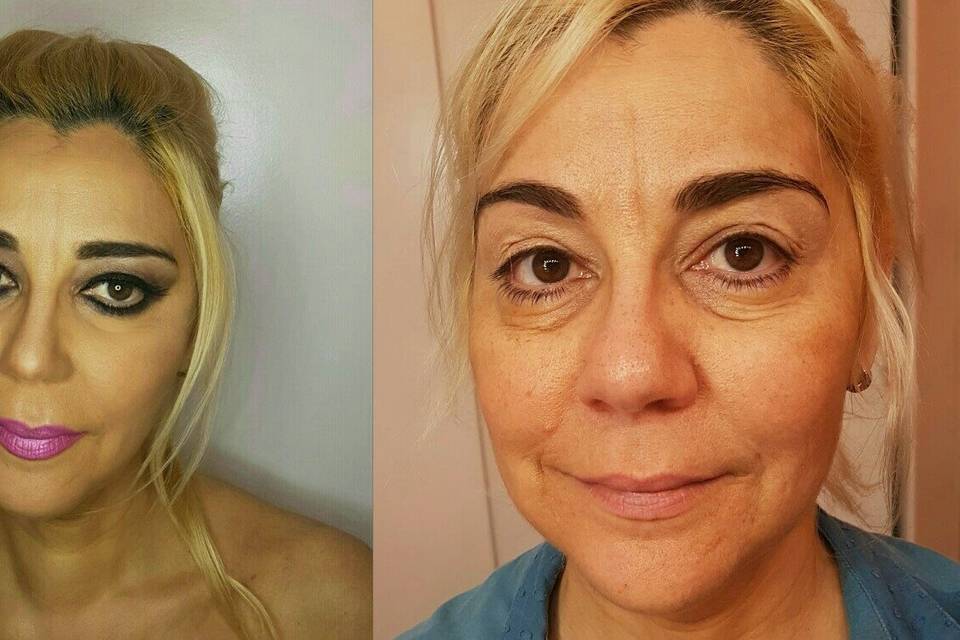 Antes/ después